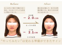 アロハ(ALOHA.)/“やりたい”は変わるの準備の印