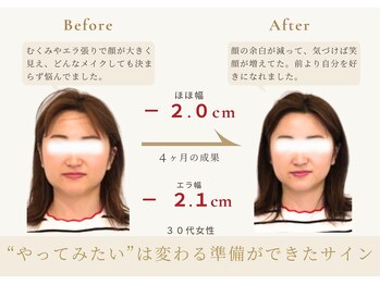 アロハ(ALOHA.)/“やりたい”は変わるの準備の印