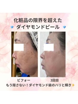 ビューティスタジオＫ/50代からの品格は上質なハリから