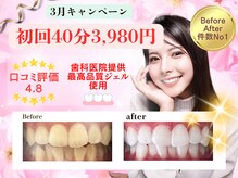 ホワイトニングショップ 鳥栖店