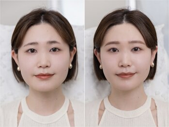 エン(En'e)の写真/＜代官山/恵比寿のおしゃれサロン＞施術当日からお顔に溶け込む自然な似合わせ眉毛を作ります。