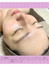 ホリホック/肌荒れ、跡、シミ、毛穴の開き