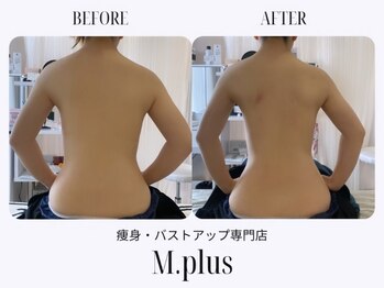 エムプリュ 心斎橋店(M.plus)/バストアップコース1一回目