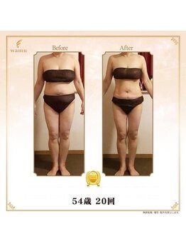 ビモア(美more)/お客様１ 前