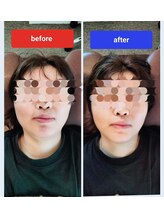 ユープラス(YOU PLUS)/before after