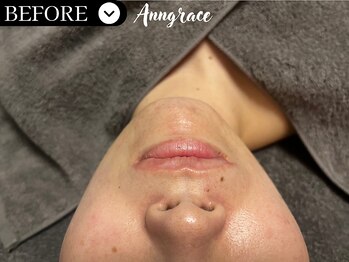 アングレイス(Anngrace)/【ポールシェリー】/Bfore