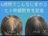髪のお悩みにはコレ！育毛促進【re:genexell (リジェネクセル)】男女OK