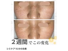 たった1回でここまで変化◎