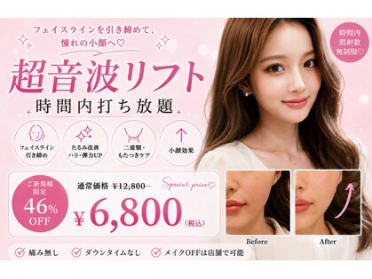 ハーシークレット(Her secret)の写真