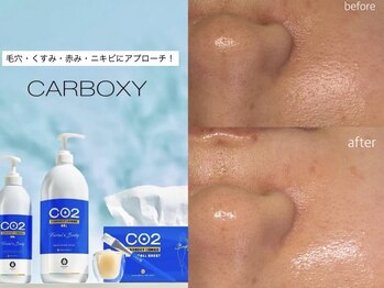 エナソール(Enasol)の写真/毛穴の開き・黒ずみにアプローチ☆最先端【高濃度炭酸ガスパック】で毛穴レスななめらかな艶肌へ♪