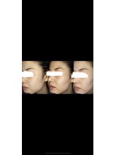 エム(eMu)/ローズドメーラー