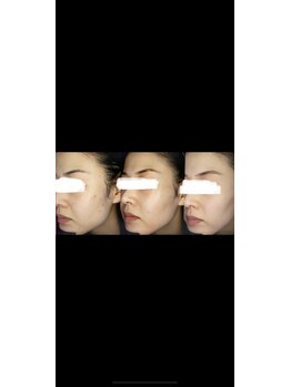 エム(eMu)/ローズドメーラー