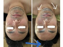 レン(REN)/小顔コルギ30分