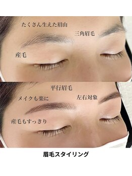 アイディアル(eyedeal)/自己処理が難しい方必見<マツパ>