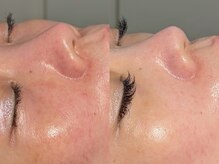 ルーナジェーナ(Luna llena)/池袋　エステ　ルーナジェーナ