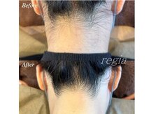 レイジア デイスパ 松本(DaySpa)の雰囲気（人気のうなじ脱毛♪自分ではなかなかお手入れできない後ろ姿美人）