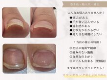 ネイルサロン エルフィン(Nail salon elfin)の雰囲気（巻き爪補正も可能◎定額ネイルも付け放題も選べてうれしい♪）