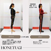 ほねつぎ総社 はりきゅう接骨院