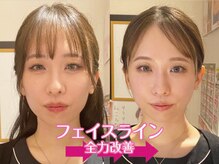ネルジム 札幌店(NERU GYM)の雰囲気（★当店しかできない手技で顔＆体を激変させます★）