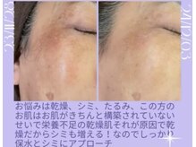 リラクゼーションサロン ラキ(laki)/スキンメイド/トロイアルケ