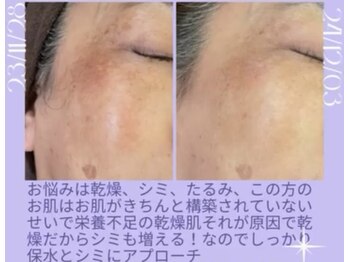 リラクゼーションサロン ラキ(laki)/スキンメイド/トロイアルケ