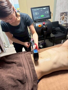 デリケート部分の脱毛/Vライン/VIO