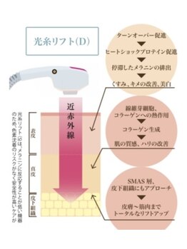 ヘルディン(heldin +555)/持続性のあるリフトアップ