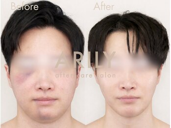 アリリィ(ARILY)/ARILY after care salon