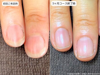 カピリナ(Ka Pilina)の写真/"自分の爪が好きになれない..."を変える!!初めての方にもおすすめの自爪育成★健康的で美しい指先に♪