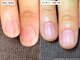 カピリナ(Ka Pilina)の写真/"自分の爪が好きになれない..."を変える!!初めての方にもおすすめの自爪育成★健康的で美しい指先に♪