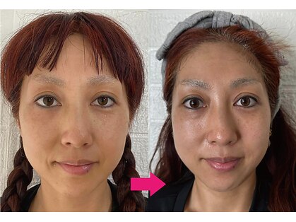 美容整体サロン オオカンシャ(okansha)の写真