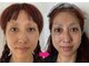 美容整体サロン オオカンシャ(okansha)の写真