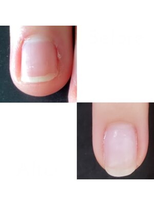 爪矯正・爪育成専門サロン　NAIL CLINIQUE 福岡店【ネイルクリニーク】