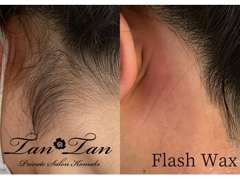 プライベートサロン タンタン(tantan)/フラッシュワックス　うなじ
