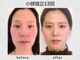 ビトリア 小顔 骨盤美容矯正サロン(BITORIA)の写真