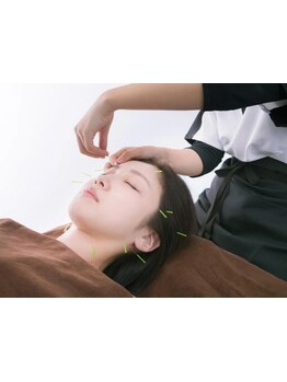 鍼灸施術を受けたい