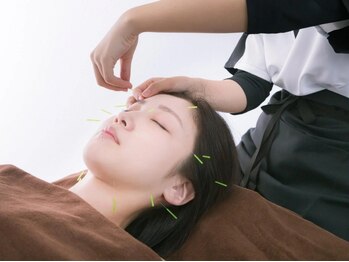 桐生ひろさわ整骨院の写真/話題の美容鍼施術でシワやたるみ、肌トラブル改善◎丁寧な施術をリラックスした空間で受けていただけます♪