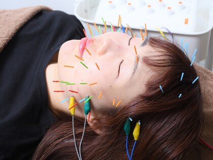 ウル鍼灸整骨院の写真