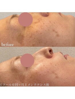 グラント ふじみ野店(grant)/