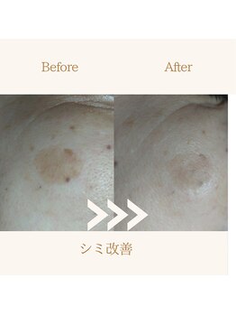 ファミル(FAMIL)/