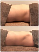 エミナル(EMINAL)/腸もみ