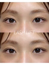 ウィロー(WILLOW)/LAASHLIFT