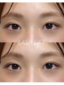 ウィロー(WILLOW)/LAASHLIFT