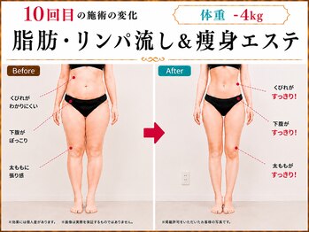 美宝 鈴蘭台の写真/人気No1★ムダ肉・贅肉を徹底的に揉み・ほぐし・吸引≪３STEP燃焼サイズダウン効果≫細魅せで劇的変化◎