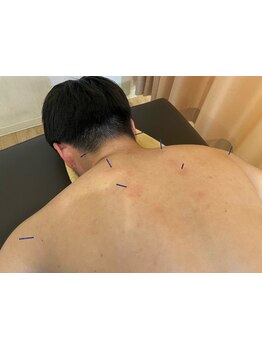 首・肩のつらさを改善したい