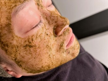 ビースキン(B SKIN)の写真/【本気で肌質改善を目指す方へ朗報！】キメの細かいスピキュール100％のハーブピーリングが今なら￥8000！