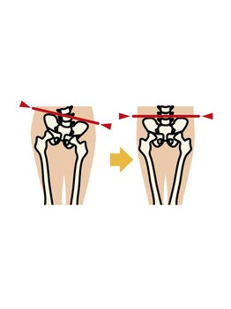 ホネツギ 柏駅西口接骨院(HONETSUGI)/骨盤ケア*歪みを整えて美BODY