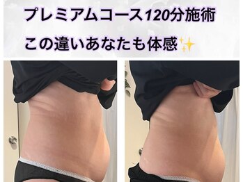 ヨサパーク ボヌール 門司駅店(YOSA PARK bonheur)/お客様の変化!