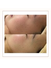 アミュレット(amulette)/インディバエンビロン