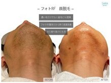 ココティ ホワイトニング(Cocotii)/系列店紹介